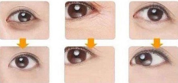 5pairs-Crystal-Collagen-Gold-Powder-Eye-Mask-Crystal-Eye-Mask-Top-Quality-Eyelid-Patch-Anti-Wrinkle