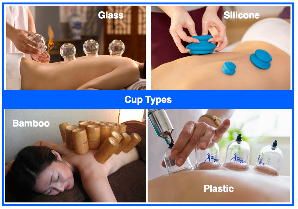 cupping-therapy-cup-types